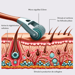 Dermaroller Pousse Cheveux Tricho-Boost