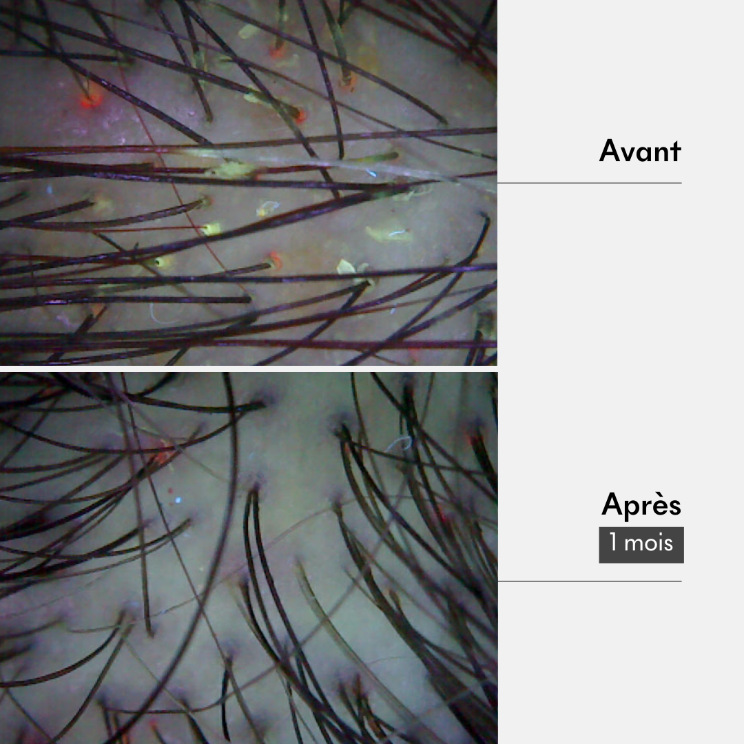 Résultat masque cheveux gras