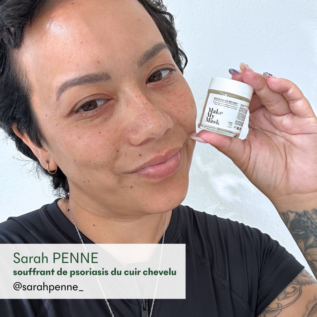 Sarah Penne, souffrant de psoriasis du cuir chevelu, recommande le complément anti-psoriasis SOS plaques sèches de MakeMyMask
