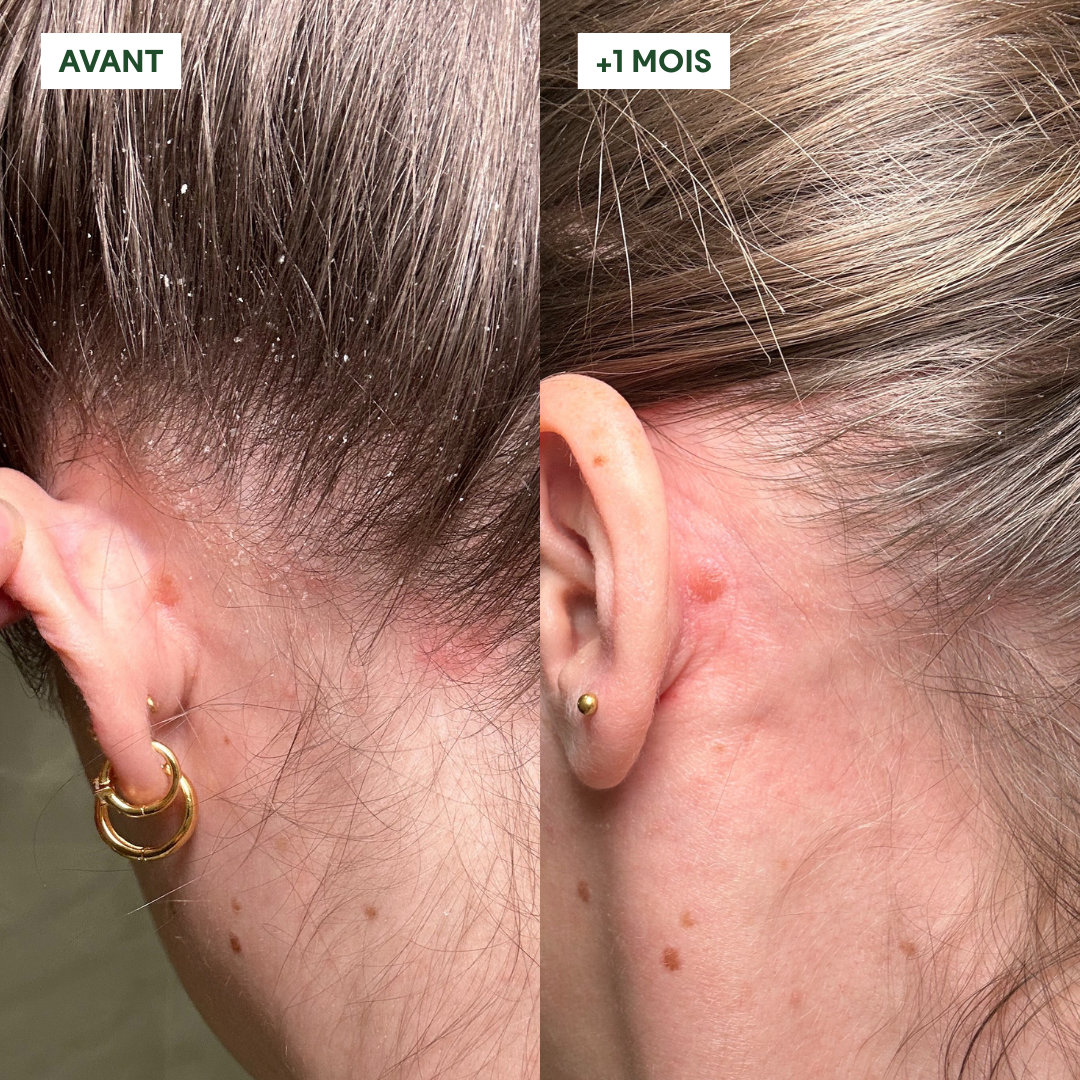 Gommage Actif Anti-Pelliculaire