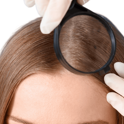 Le "Scalp Care" : pourquoi traiter les racines plutôt que les longueurs - MakeMyMask
