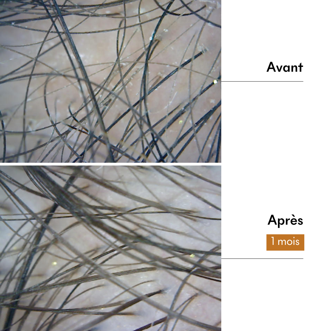 Protocole Cheveux fins