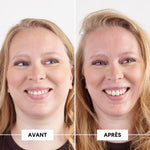 Aktives Volumenpeeling – Feines Haar