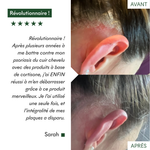 Complément SOS Plaques Sèches