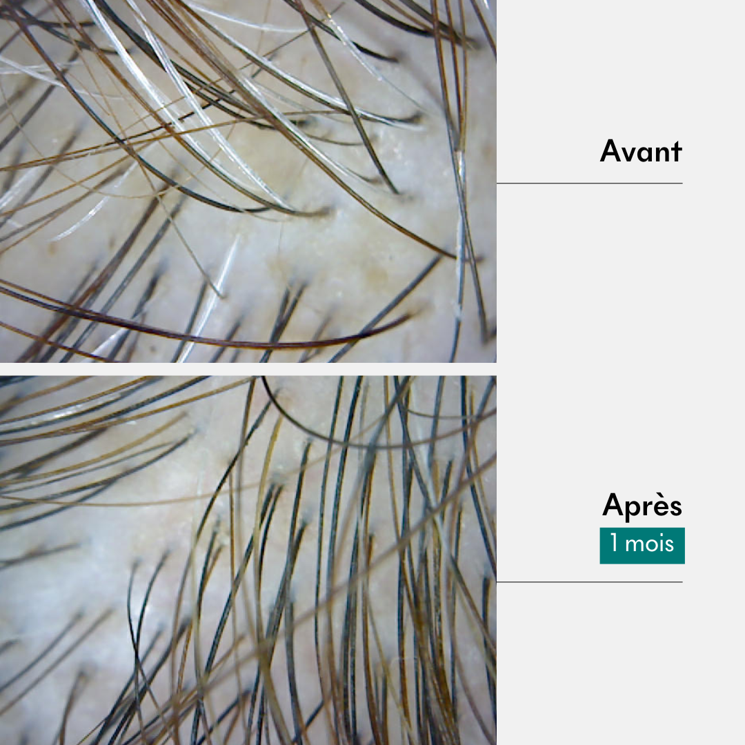 Resultat soin pre-shampoing anti-cheveux blancs
