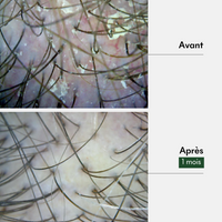 Protocole Anti-Pellicules Sèches