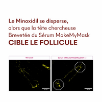 Protocole Anti-Chute Hormonale