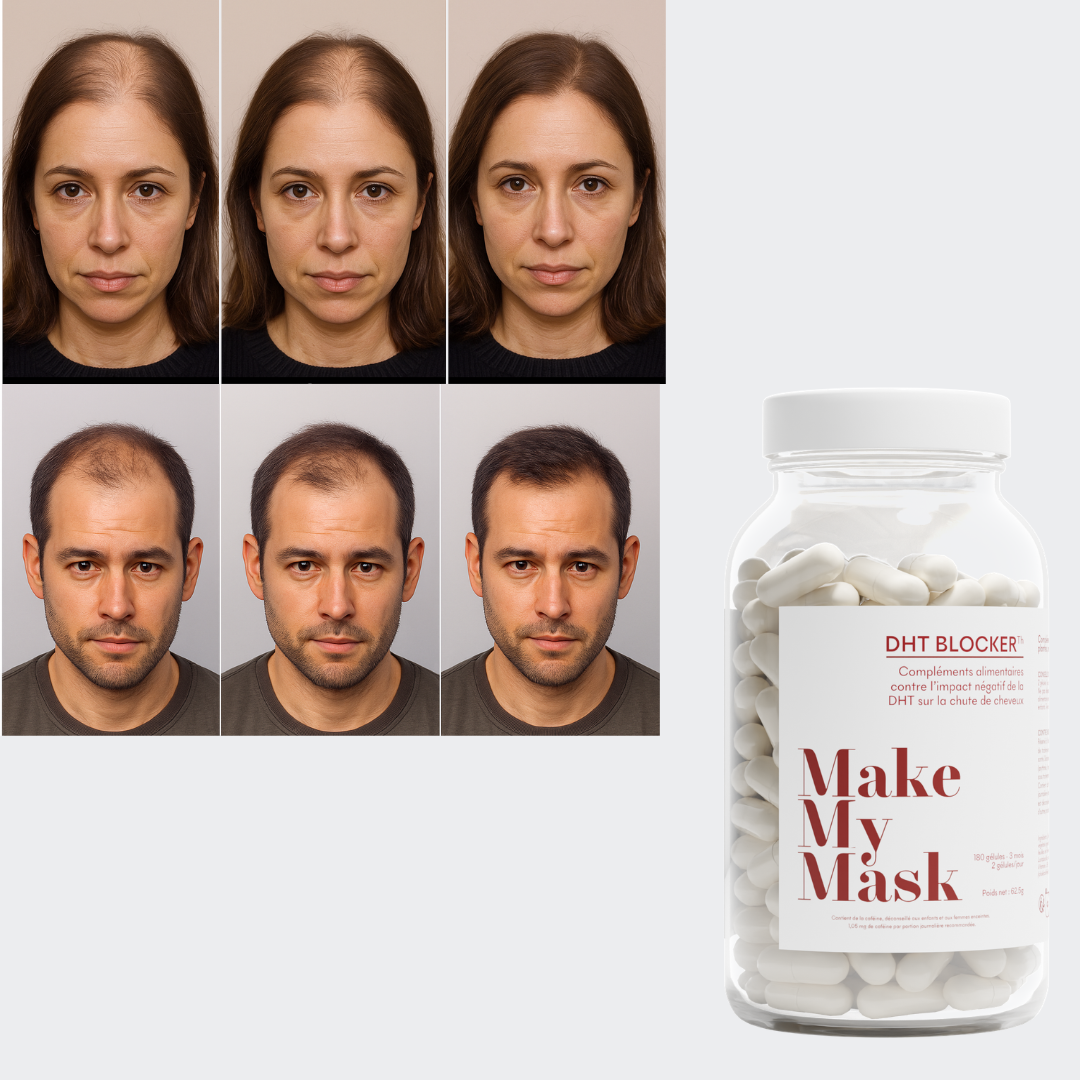 DHT Blocker Anti-Chute Hormonale 3 MOIS