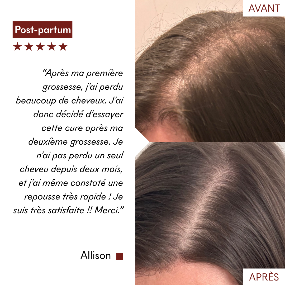 Gommage Actif Anti-Chute & Pousse