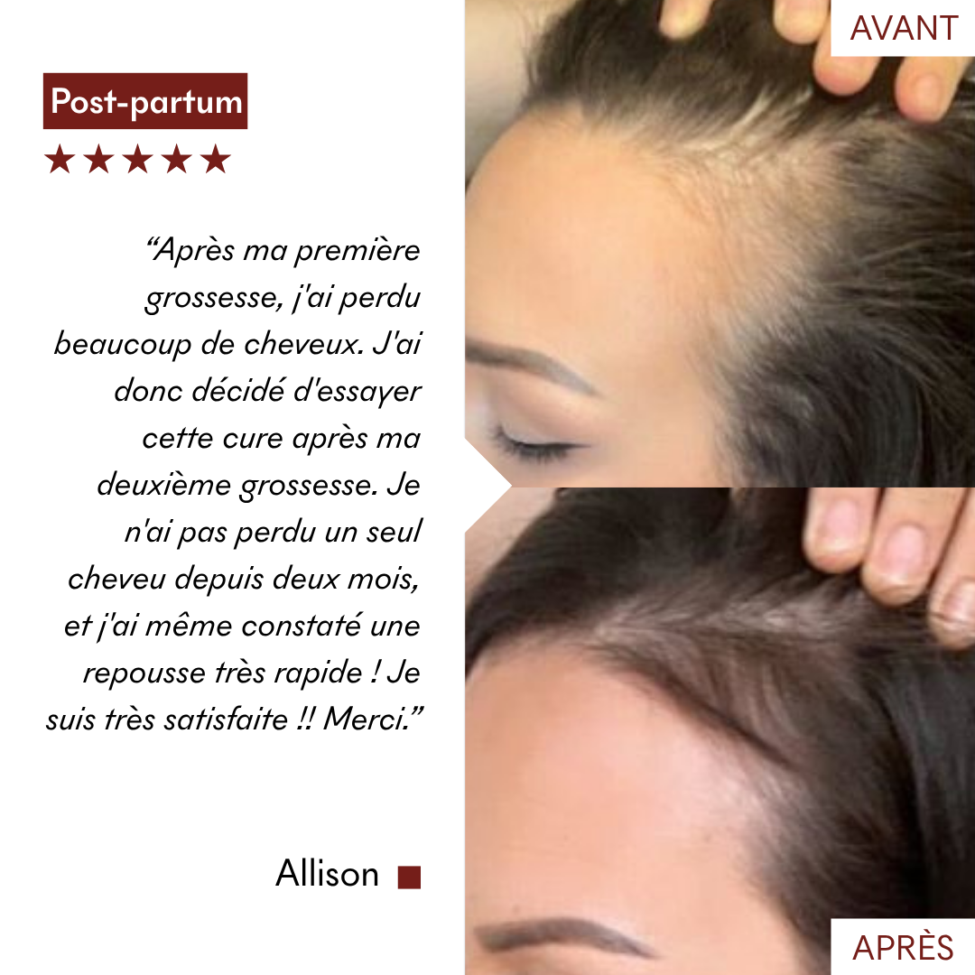 anti_chute_avant_apres_makemymask (3).png__PID:162053c1-7a0a-4439-b89b-05fcd92b9576
