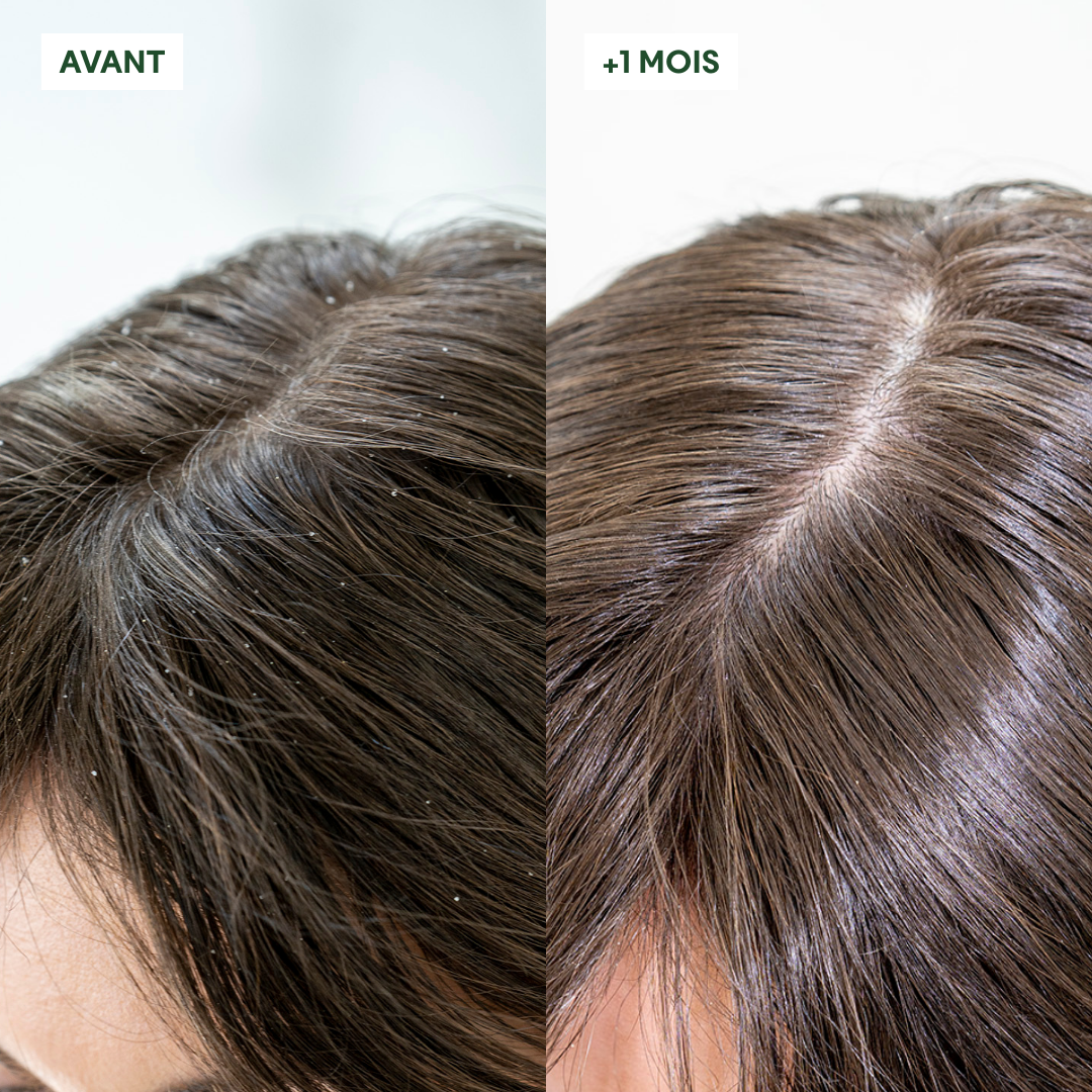 OFFRE 2 Gommages Anti-Pell= 1 Shampoing offert