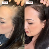 Gommage Actif Anti-Chute