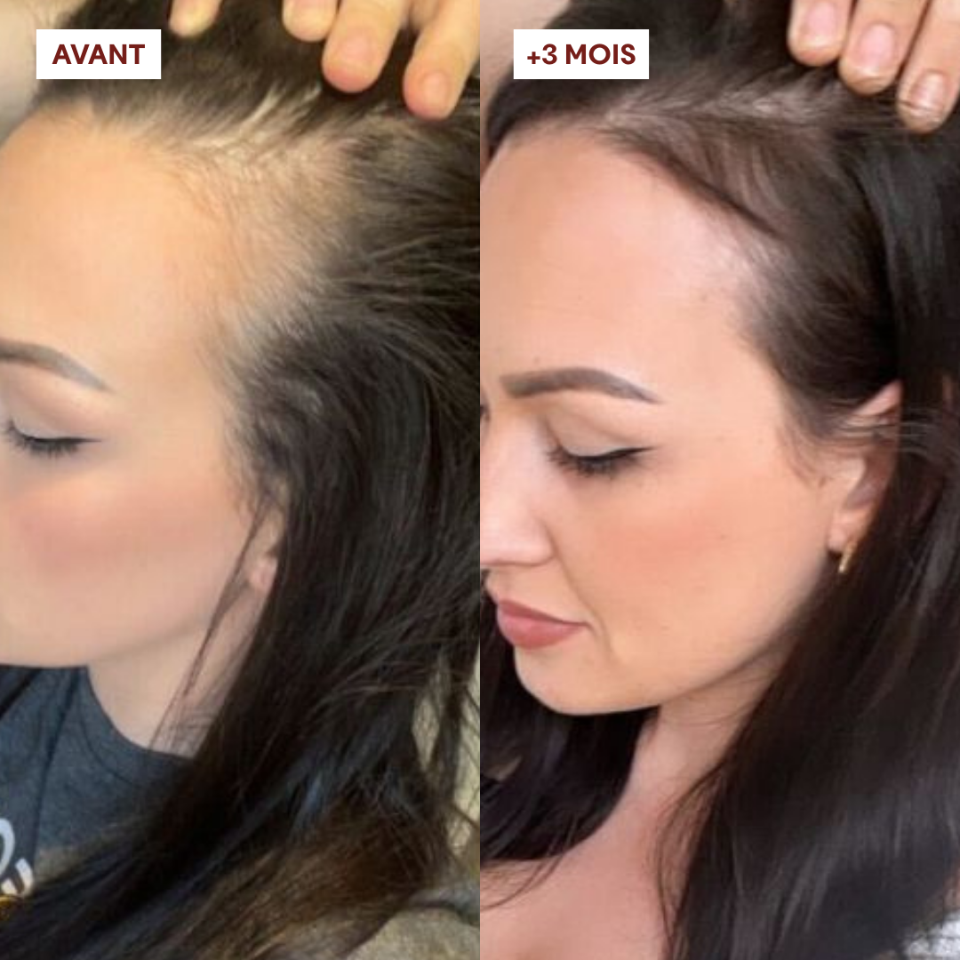 Gommage Actif Anti-Chute