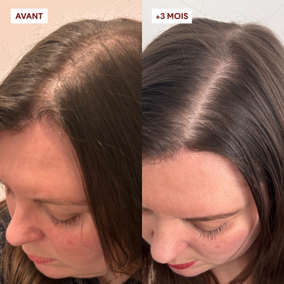 Gommage Actif Anti-Chute