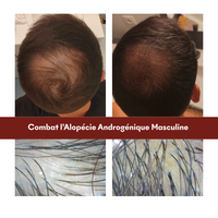 Protocole Anti-Chute Hormonale