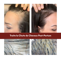 Protocole Chute Post-Partum