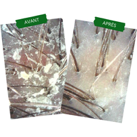 Concentré Anti-PSO & Plaques