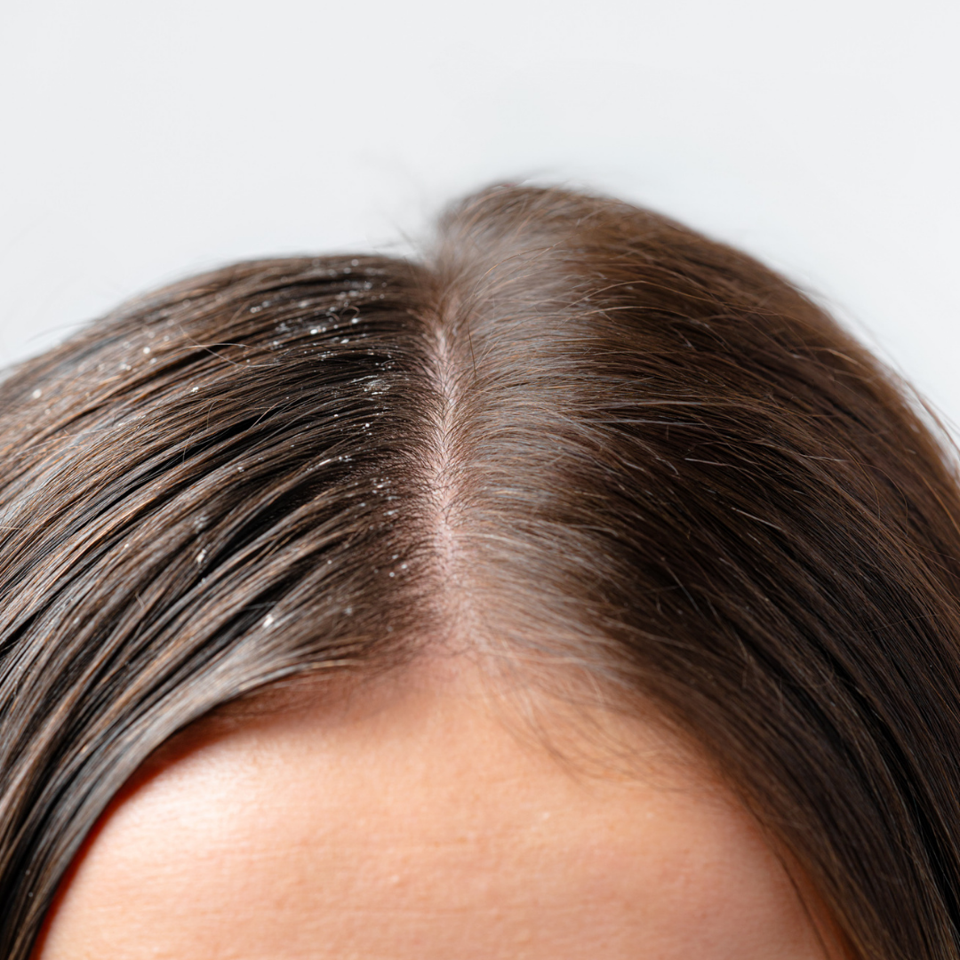 OFFRE 2 Gommages Anti-Pell= 1 Shampoing offert