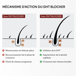 DHT Blocker Anti-Chute Hormonale 3 MOIS