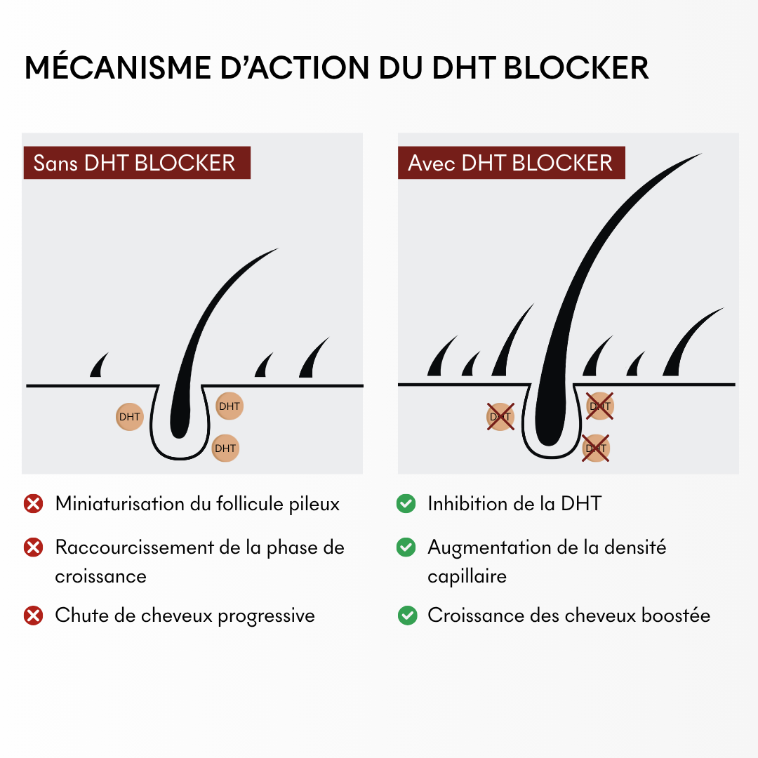 DHT Blocker Anti-Chute Hormonale 3 MOIS
