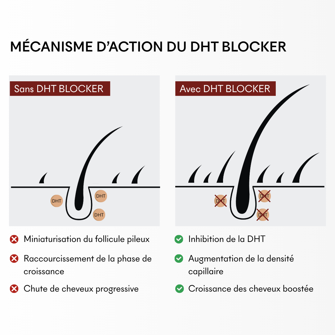 Protocole Anti-chute Hormonale