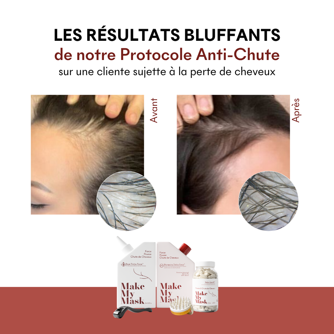 Tricho-Force pH5 Anti-Hair Loss Shampoo
