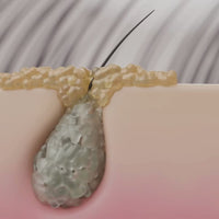 Gommage Actif Anti-Chute & Pousse