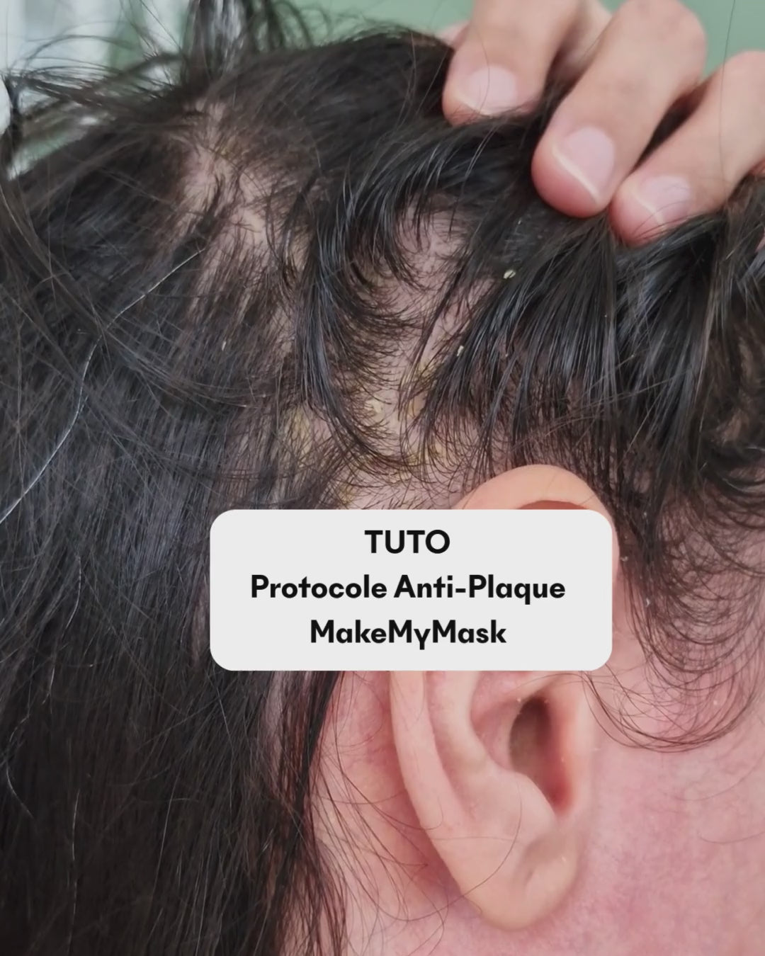 Complément SOS Plaques Sèches