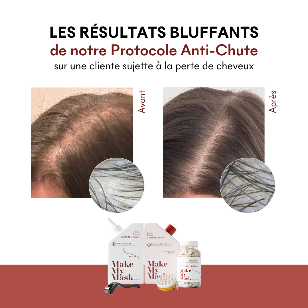 protocole_anti_chute_pousse_de_cheveux_avant_après_résultats