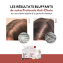 Protocole Anti-chute & Pousse personnalisable