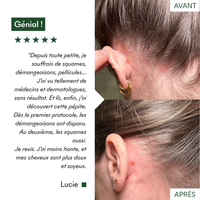 Gommage Actif Anti-Pelliculaire