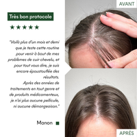Gommage Actif Anti-Pelliculaire
