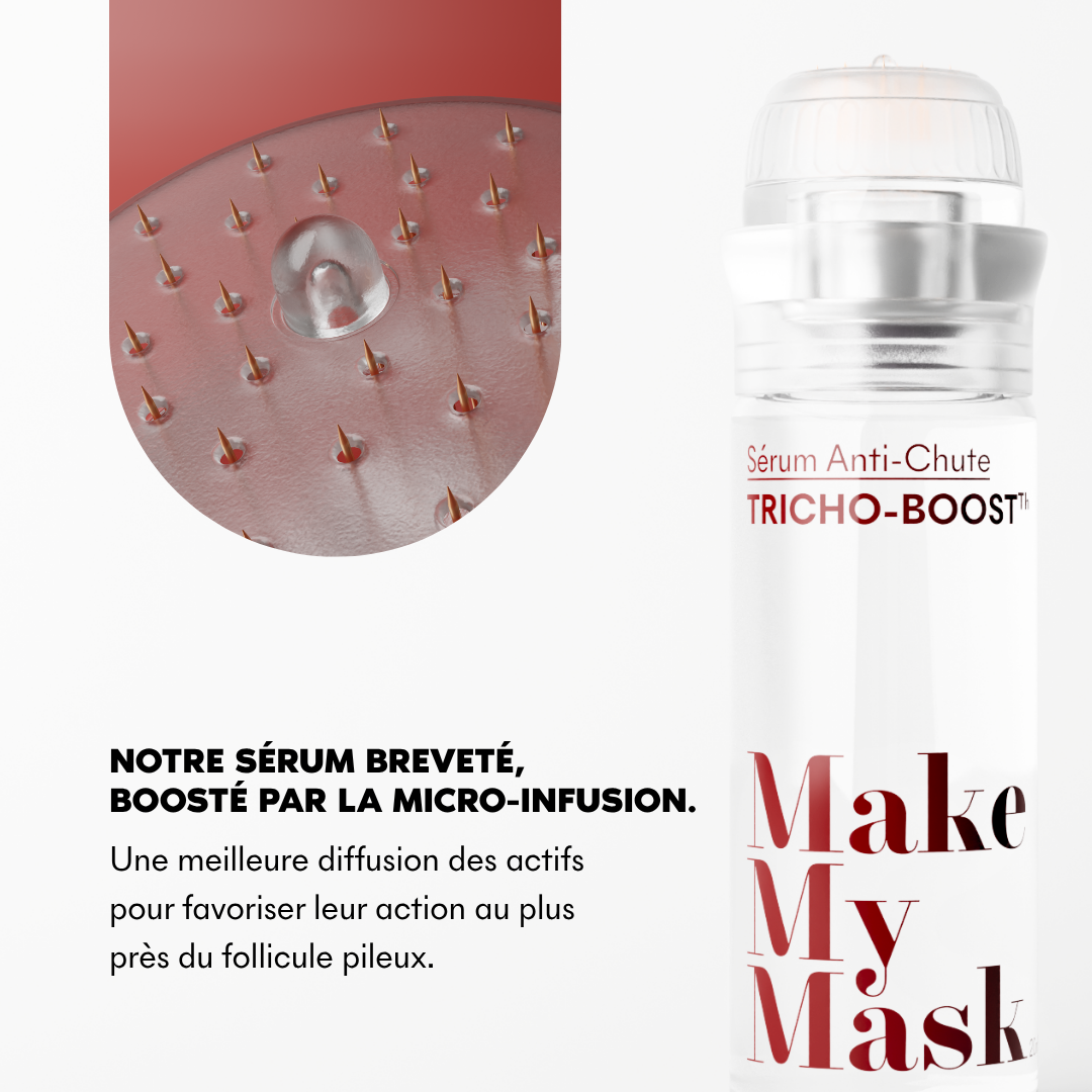 Microinfusión anticaída