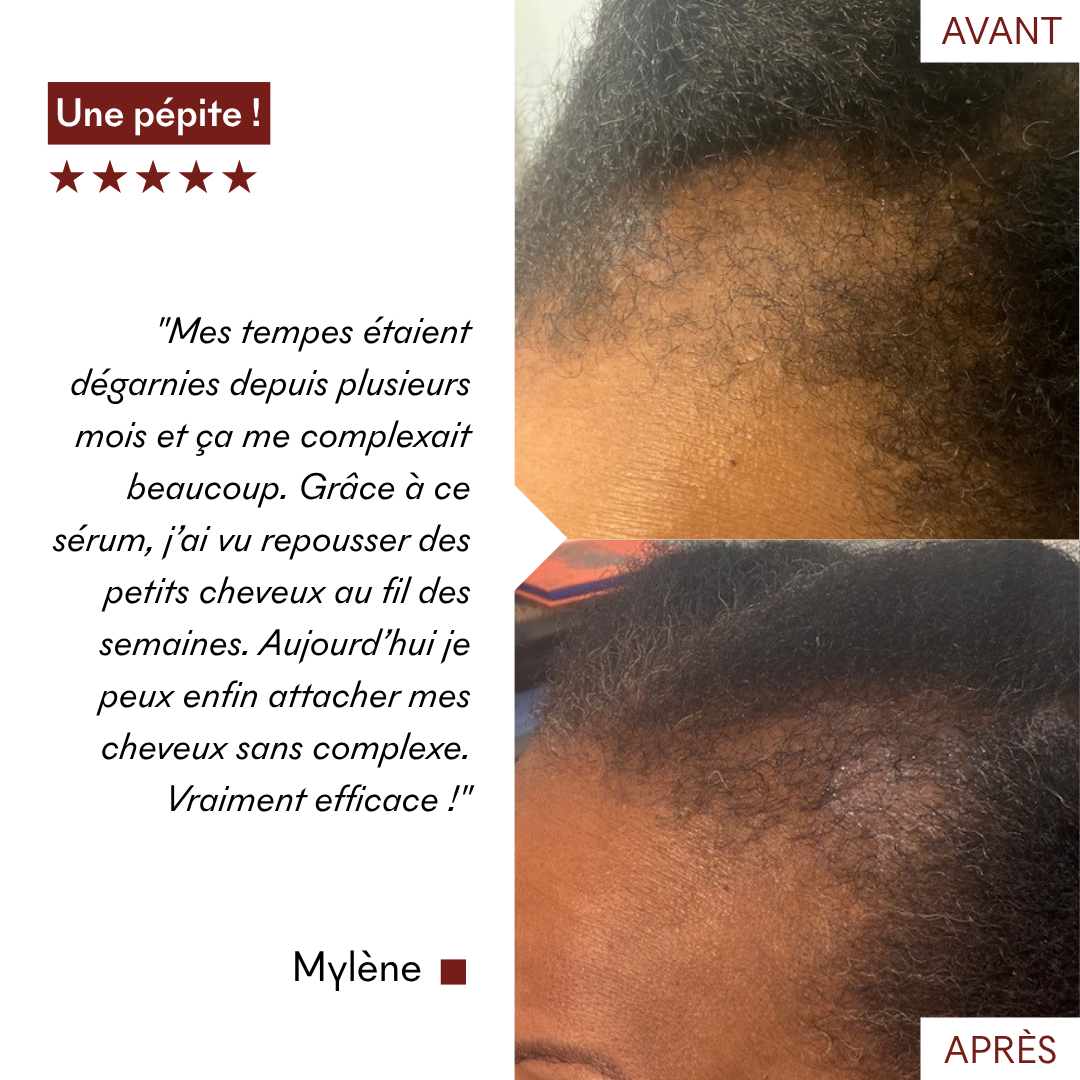 serum_anti_chute_avant_apres_mylene_makemymask.png__PID:f47231a0-bcca-4fdc-965e-e9f799e69295