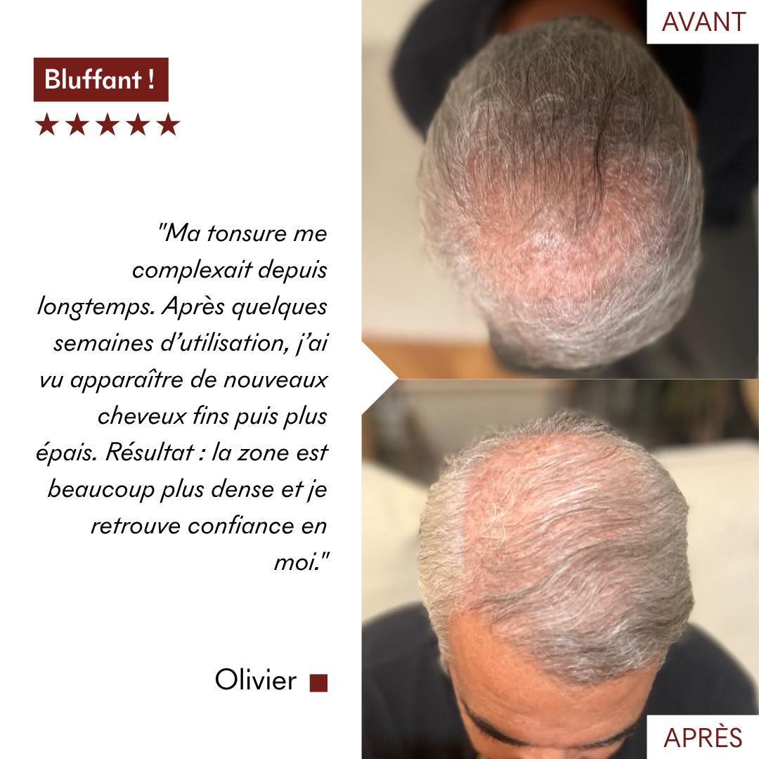serum_anti_chute_avant_apres_olivier_makemymask.png__PID:60a5bf34-e3c4-4941-a44b-e975f491c056