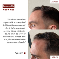 Sérum Anti-Chute Tricho-Boost