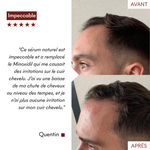 DHT Blocker Anti-Chute Hormonale [précommande]