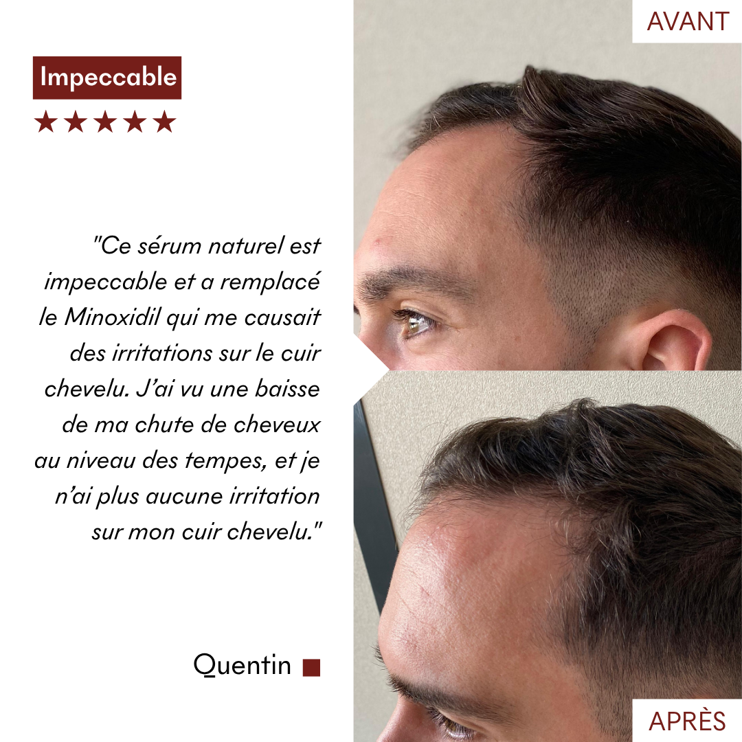 serum_anti_chute_avant_apres_quentin_makemymask.png__PID:60a5bf34-e3c4-4941-a44b-e975f491c056