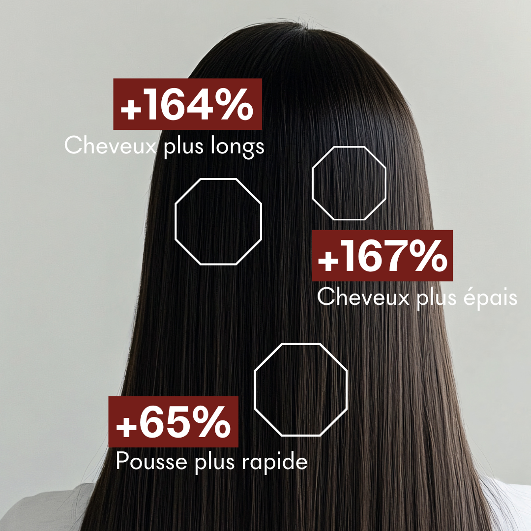Protocole Anti-Chute Réactionnelle