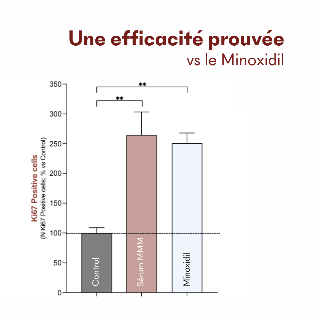 Protocole Alopécie Androgénique Féminine