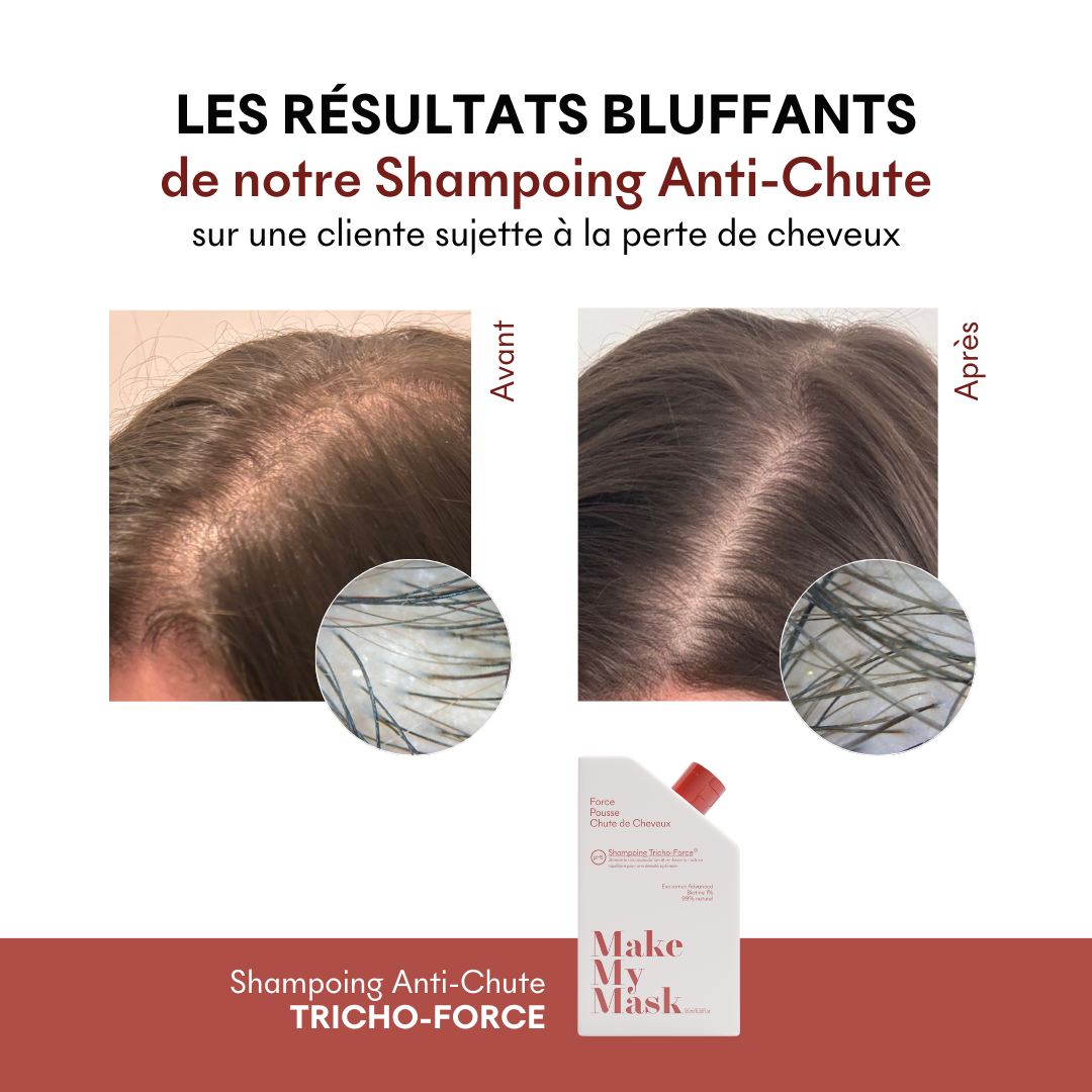 champú anticaída antes y después