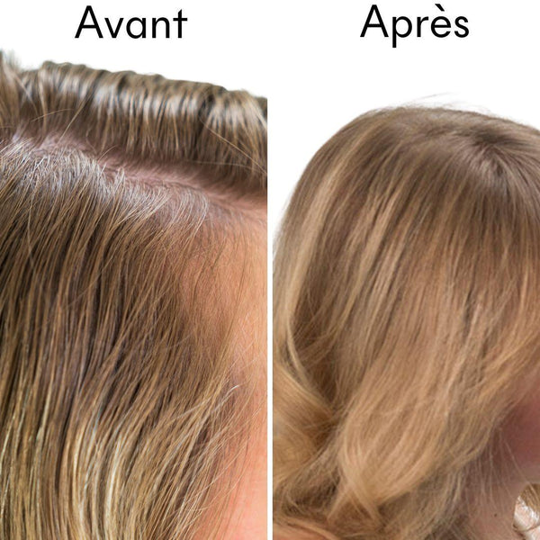 Kit Détox - Cheveux gras